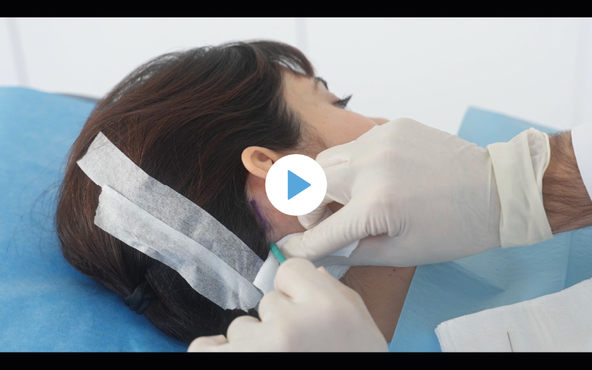 Video step by step-03