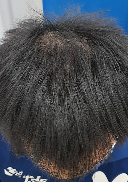 Dr. Joshua Chong - After