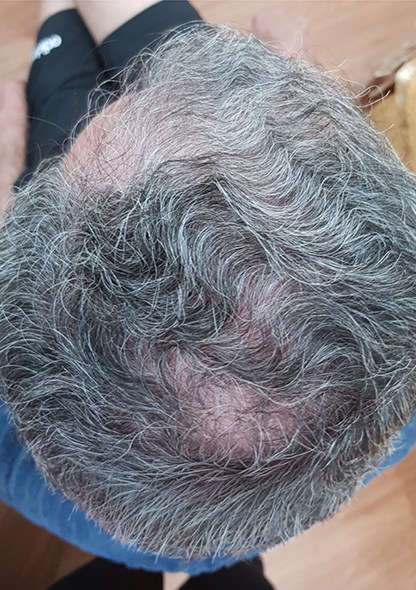 Dr. Joshua Chong1 - Before
