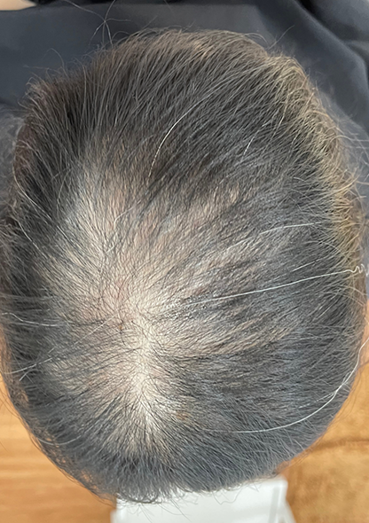 Dr. Joshua Chong - Before