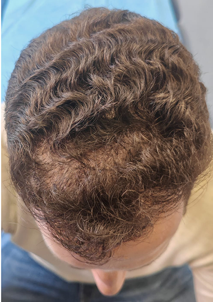 Dr. Joshua Chong - Before