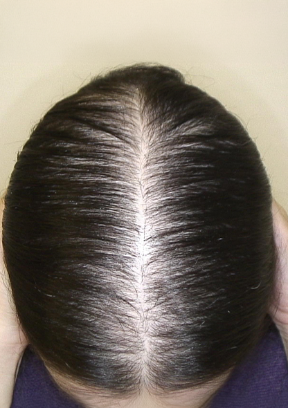 Dr. Joshua Chong 2 ar - Before