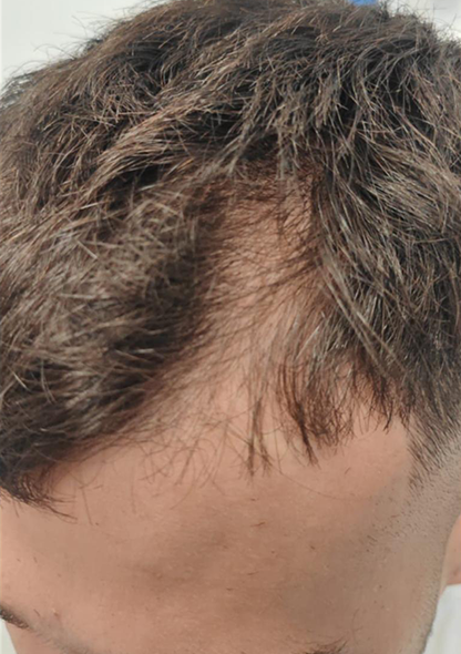 Dr. Joshua Chong ar - Before